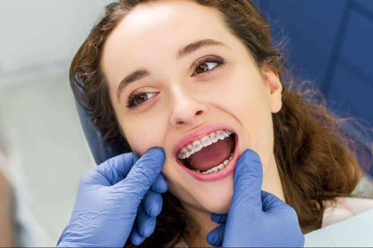¿Cuáles son los beneficios de la ortodoncia estética?, por Agudo Rosa - corporate.es