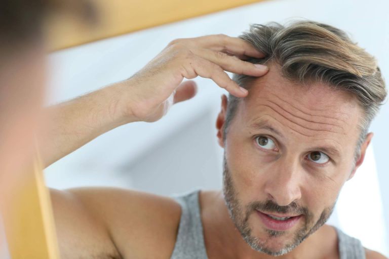 ¿Cuál es la mejor edad para hacerse un injerto capilar?, por MC360 - corporate.es